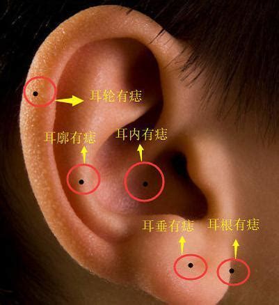 耳廓上有痣|耳朵长痣的位置图解 耳朵长痣的位置图解有福气